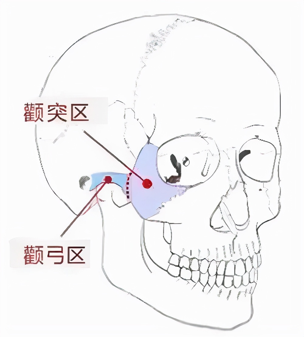 怎样改变菱形脸（菱形脸怎么改变脸型）(图2)