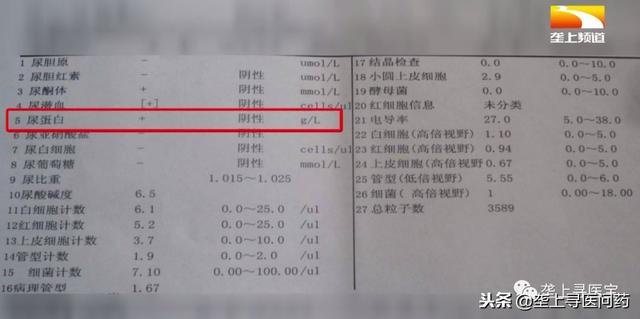 教你看懂尿常规（尿检报告看的一头雾水）(11)