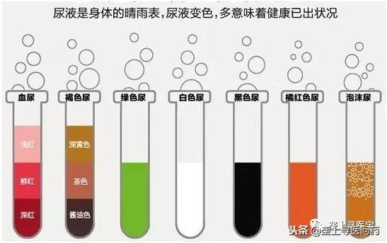 教你看懂尿常规（尿检报告看的一头雾水）(17)