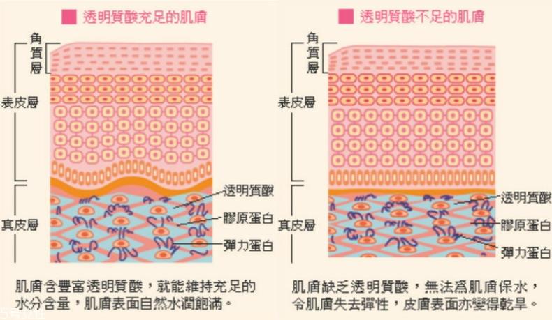 干性肌肤怎么抗皱 干性肌抗皱注意三点