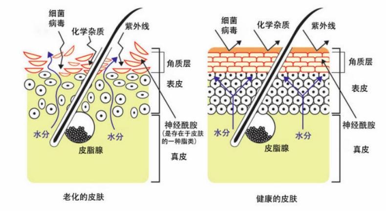 干性肌肤怎么抗皱 干性肌抗皱注意三点