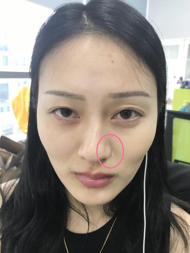 real skin patch怎么样？real skin是什么牌子