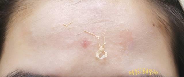 real skin patch怎么样？real skin是什么牌子