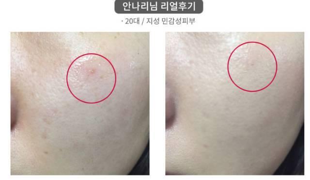 real skin patch怎么样？real skin是什么牌子