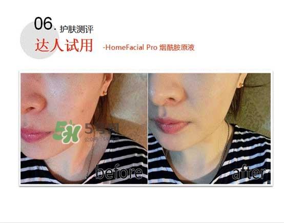 homefacialpro烟酰胺原液怎么样？hfp烟酰胺原液好用吗