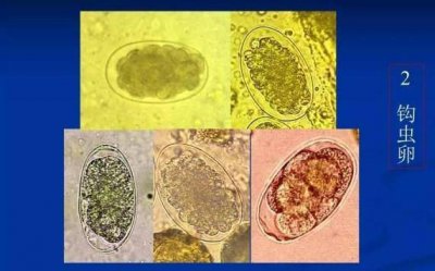 ​寄生虫-所有动物寄生虫大全临床诊断预防全在这里，收藏吧（图）