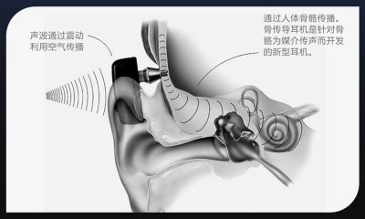 ​骨传导耳机会损伤大脑吗？骨传导耳机有什么优点